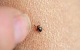 Brown tick on a human skin
