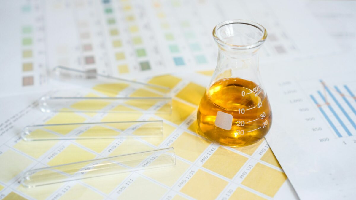 Flask and test tubes with urine on medical color schemes. Concept of analyzes