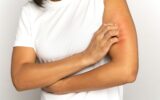 Girl scratching itch on hand, suffer from dry skin or pruritus, animal allergy, insect bites. Studio